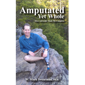 Amputated Yet Whole: How Adversity Made Me Complete
