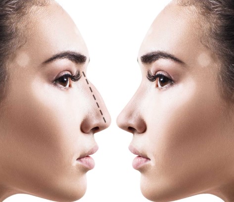 Completing Your Health Transformation by Refining the Lower Profile